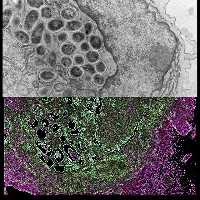 TEM and density reconstruction